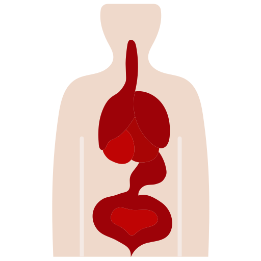 Congenital Diaphragmatic Hernia