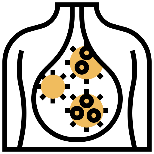 Choletihiasis