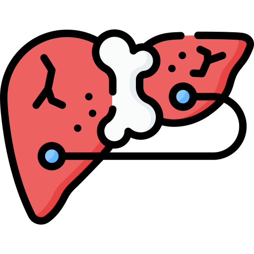 Pancreas Tumors