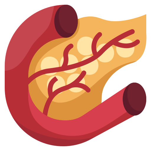 Pancreas Divisum