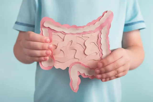 Ulcerative Colitis
