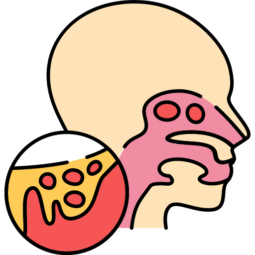 Epididymitis & Orchitis