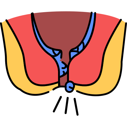 Thyroglossal Duct Cyst Excision