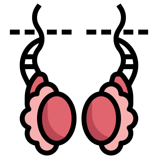 Omphalocele