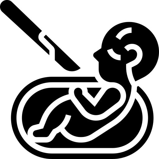 Umbilical Hernia