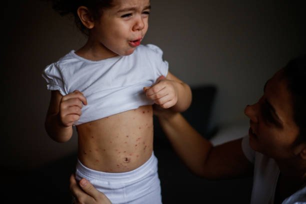 Choletihiasis