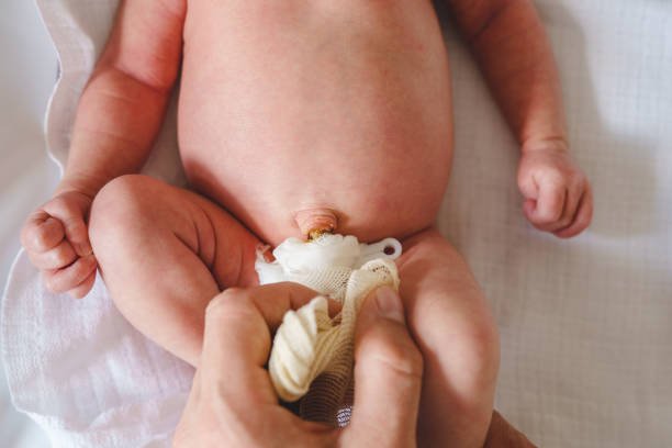 Inguinal Hernia Repair