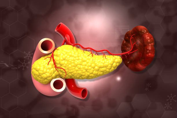 Pancreas Divisum