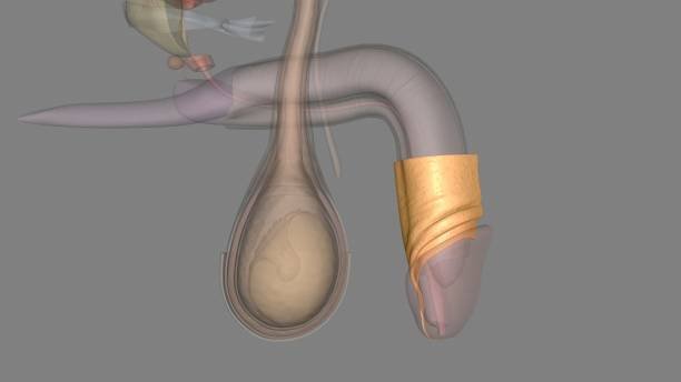 Posterior Urethral Valve