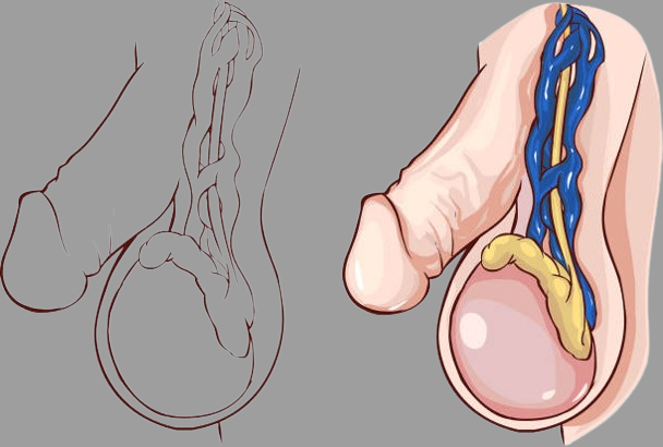 Urethral Strictures