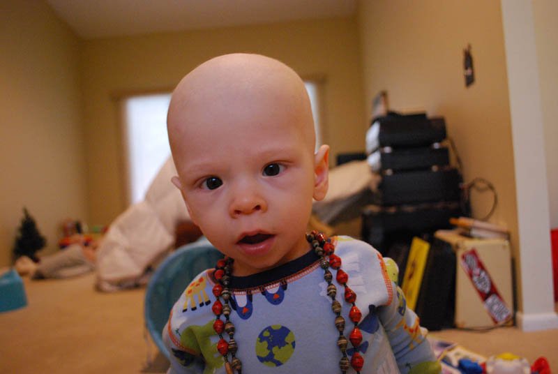 Neuroblastoma