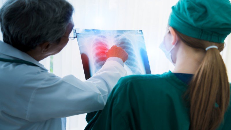 Best Thoracic Surgeon in Ghaziabad