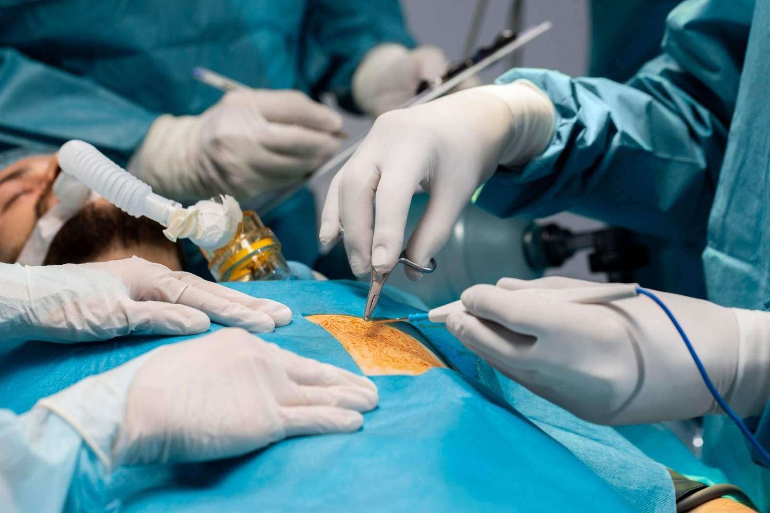 Pediatric Umbilical Hernia Surgeon in Ghaziabad