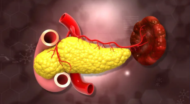 Untitled design - 2025-06-20T145443.441