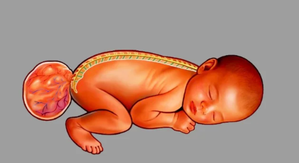 Untitled design - 2025-06-23T110946.110