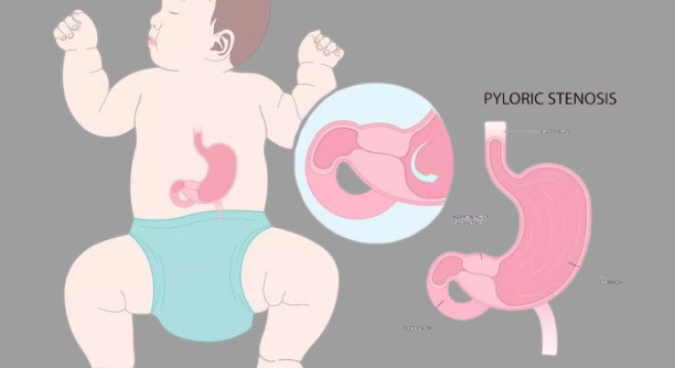 d9772f50bf7da33a32e2f24efd4da2a6-removebg-preview